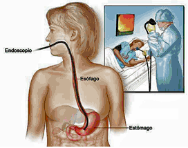 Endoscopia